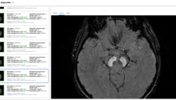 substantia-nigra-2d